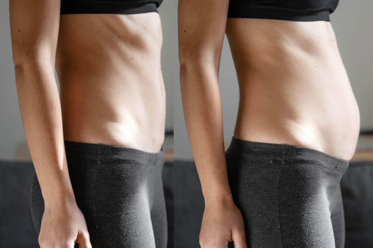 How long does diastasis recti take to improve Brackley?