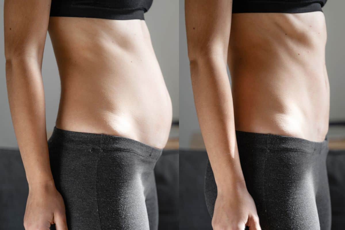 Post-Pregnancy: What Happens to Your Abdominal Muscles After Birth Brackley