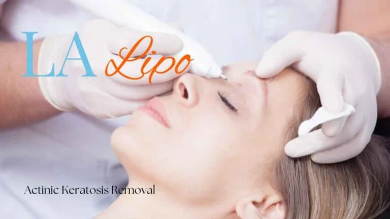Woman receiving Actinic Keratosis Removal Treatment Brackley