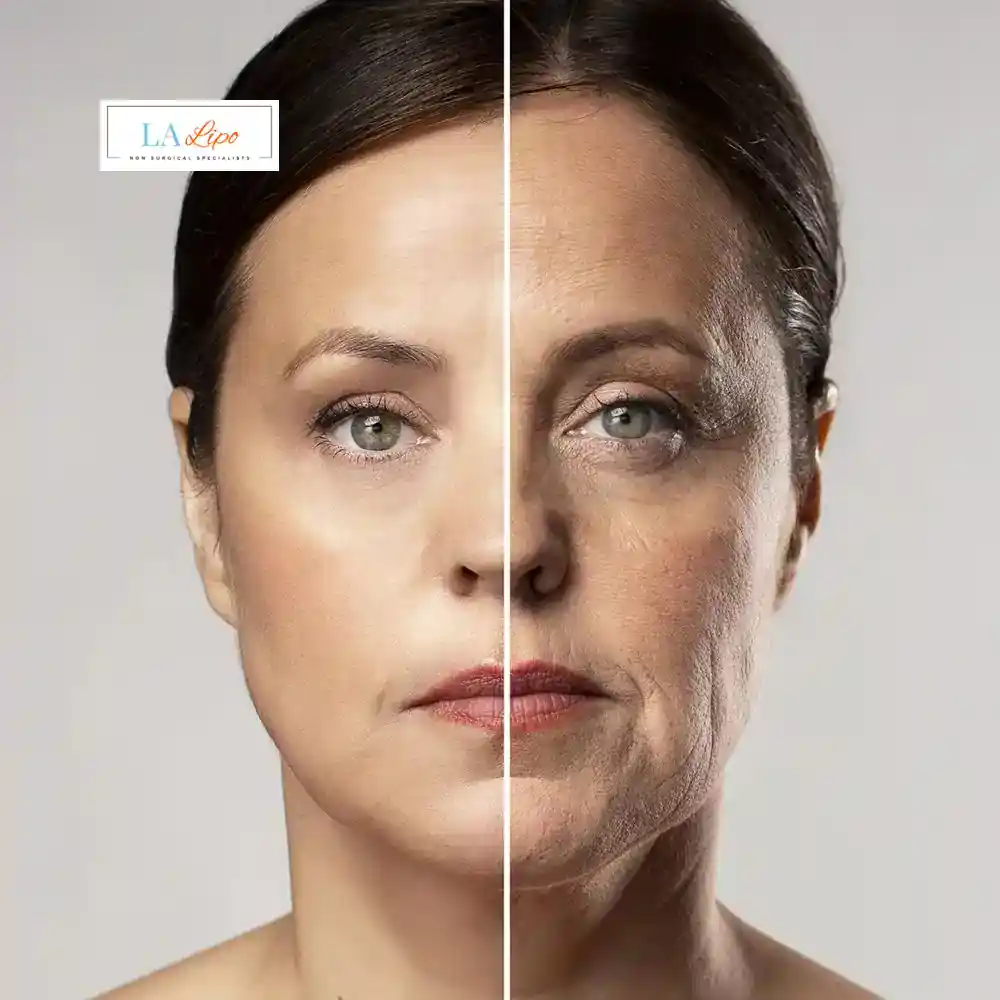 How Can You Tell If Non-Surgical Skin Tightening Is Right for You Brackley?