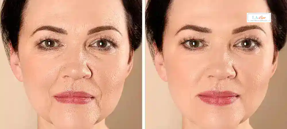 Why Aren’t My Skincare Products Making My Sagging Skin Look Firmer Brackley?