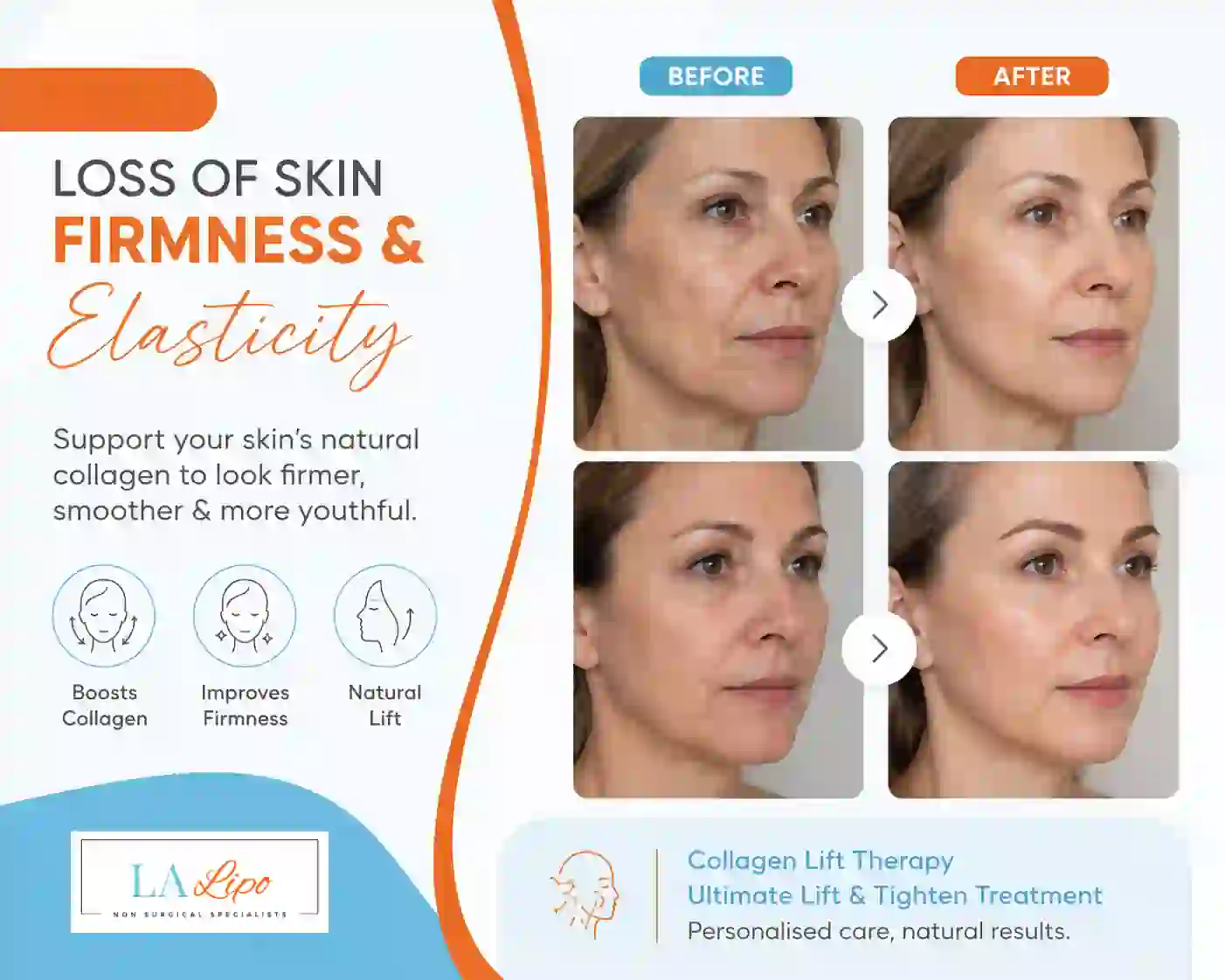 Sign #7: Loss of Skin Firmness and Elasticity Brackley