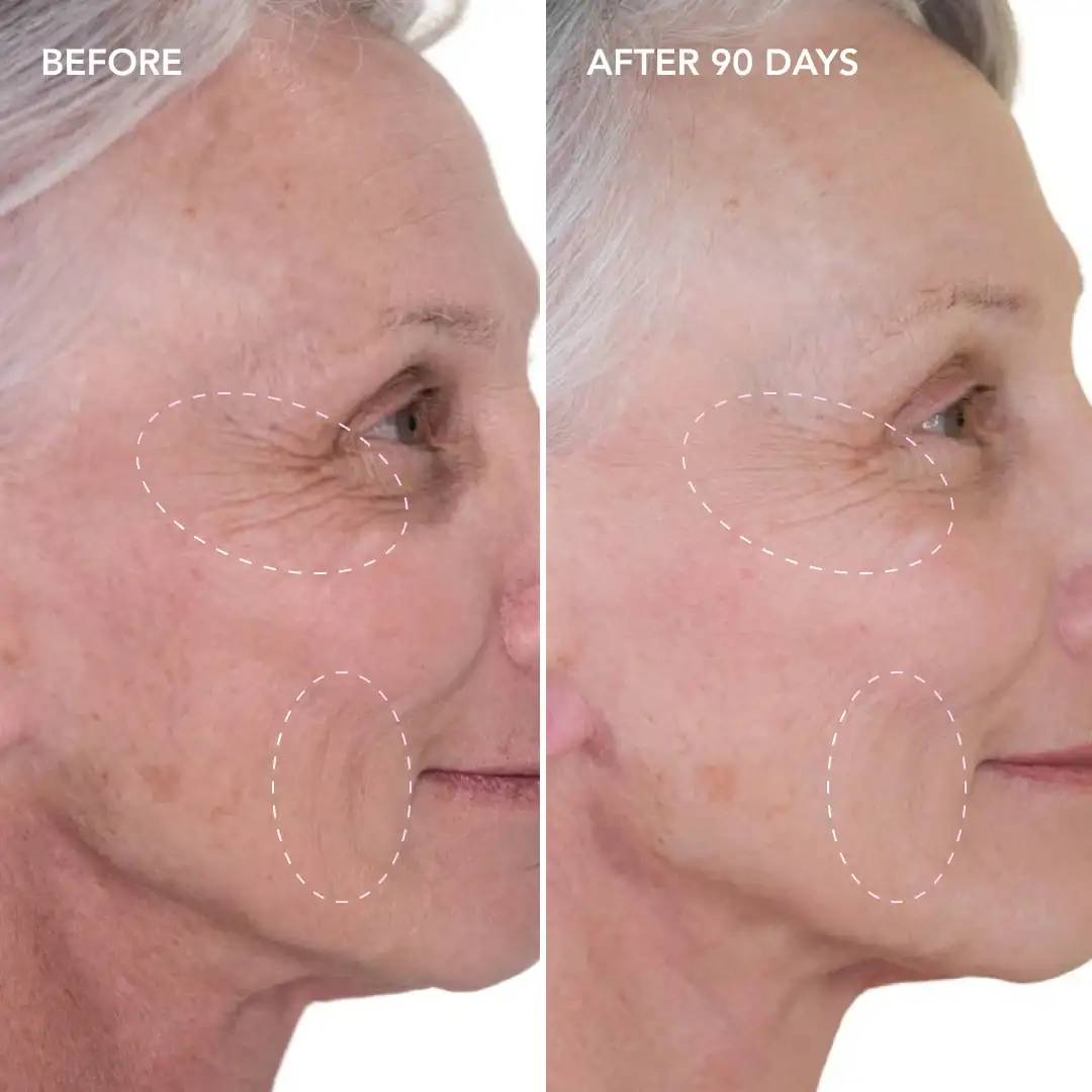 When will you see results Brackley